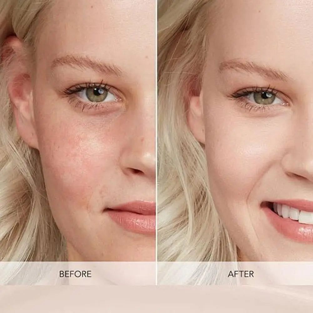 30ml Volufiline 92% + Pal-Isoleucine 1% Plumping Serum with Niacinamide Plumping Anhydrous Skin Radiance Boosting Facial Serum