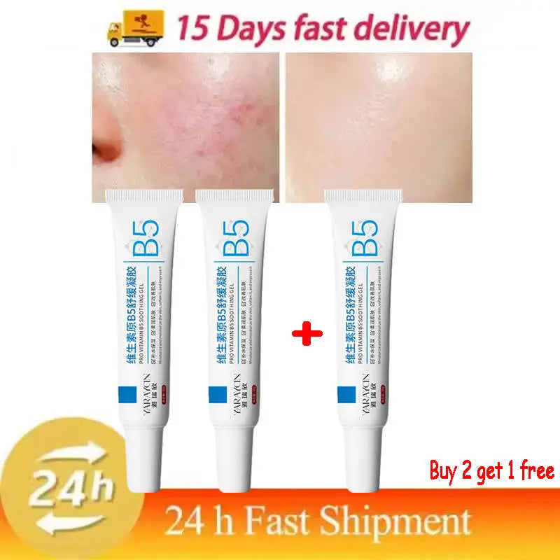 Facial Redness Repair Cream Improve Sensitive Skin Dryness Moisturizer Hydrating Sooth Lotion Removal Rosacea Korean Cosmetics