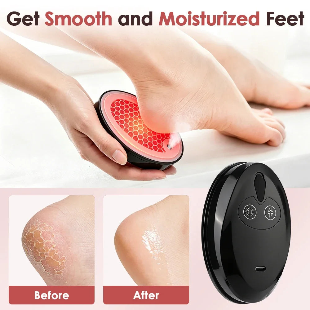Hydrating Electric Foot Grinder Red Blue Light Therapy Foot Callus & Dead Skin Remover USB Rechargeable Spraying Pedicure Tool