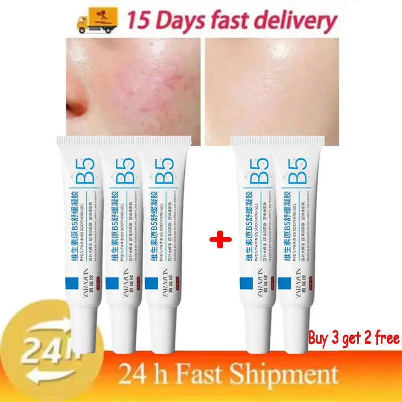 Facial Redness Repair Cream Improve Sensitive Skin Dryness Moisturizer Hydrating Sooth Lotion Removal Rosacea Korean Cosmetics